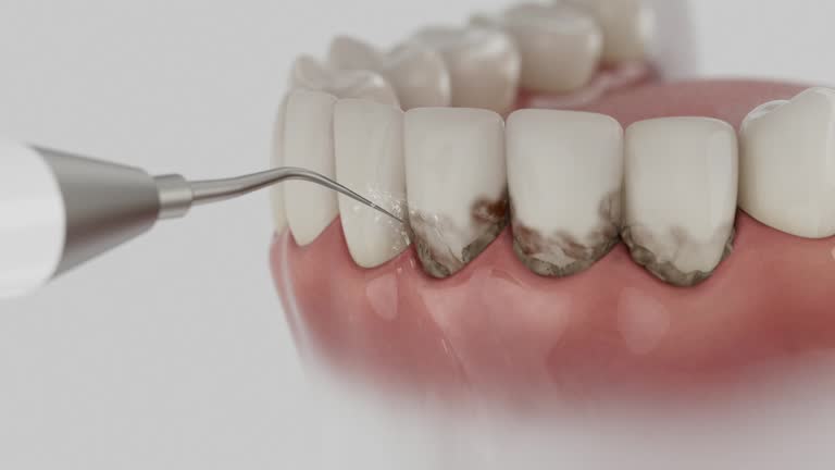Trusted Teeth Cleaning And Checkup service in Lincoln, CA - Dentist Open Now